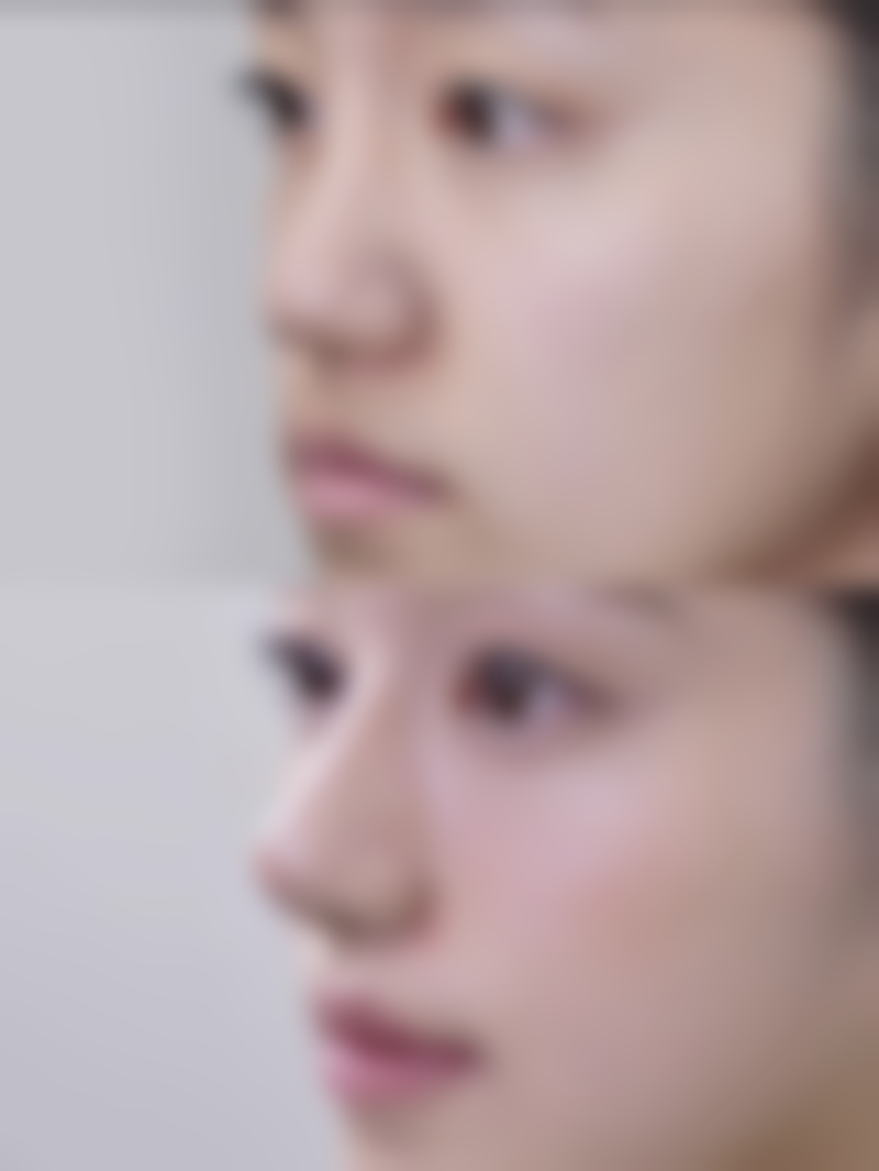 丰太阳穴之选对医院：保护成效与安心