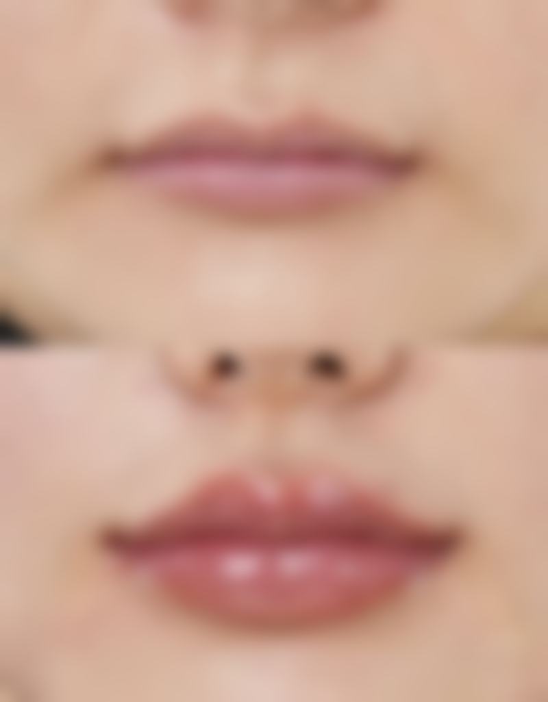 怎样极速消除眼袋？隐匿切口、快速修复，还你年轻明亮双眸！ 