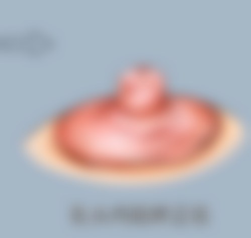 非经期割双眼皮,优势大揭秘