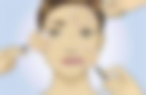 陈突牙齿美学修复水平怎么样可靠吗？