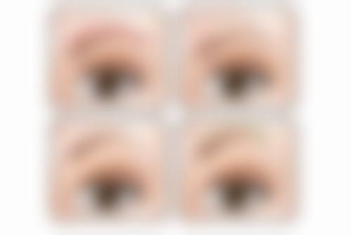 降低修复手术风险的要点