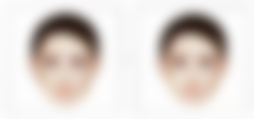 增生性疤痕治疗之手术方案揭秘，重塑光滑肌肤不是梦