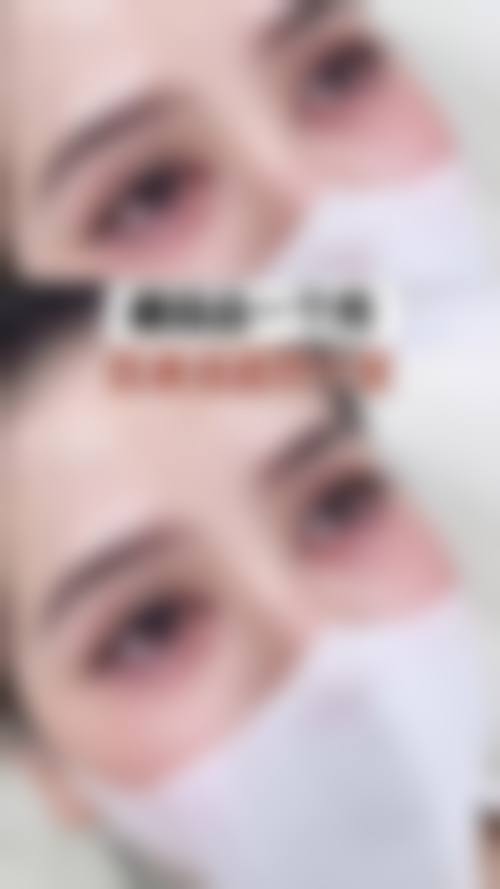 李森恺面部整形实例