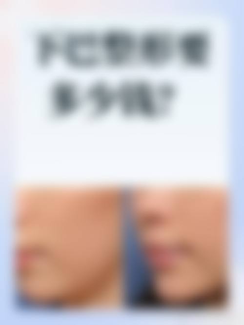 柳圣贤怎么预约？