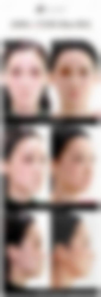 柳圣贤项目价格表参考