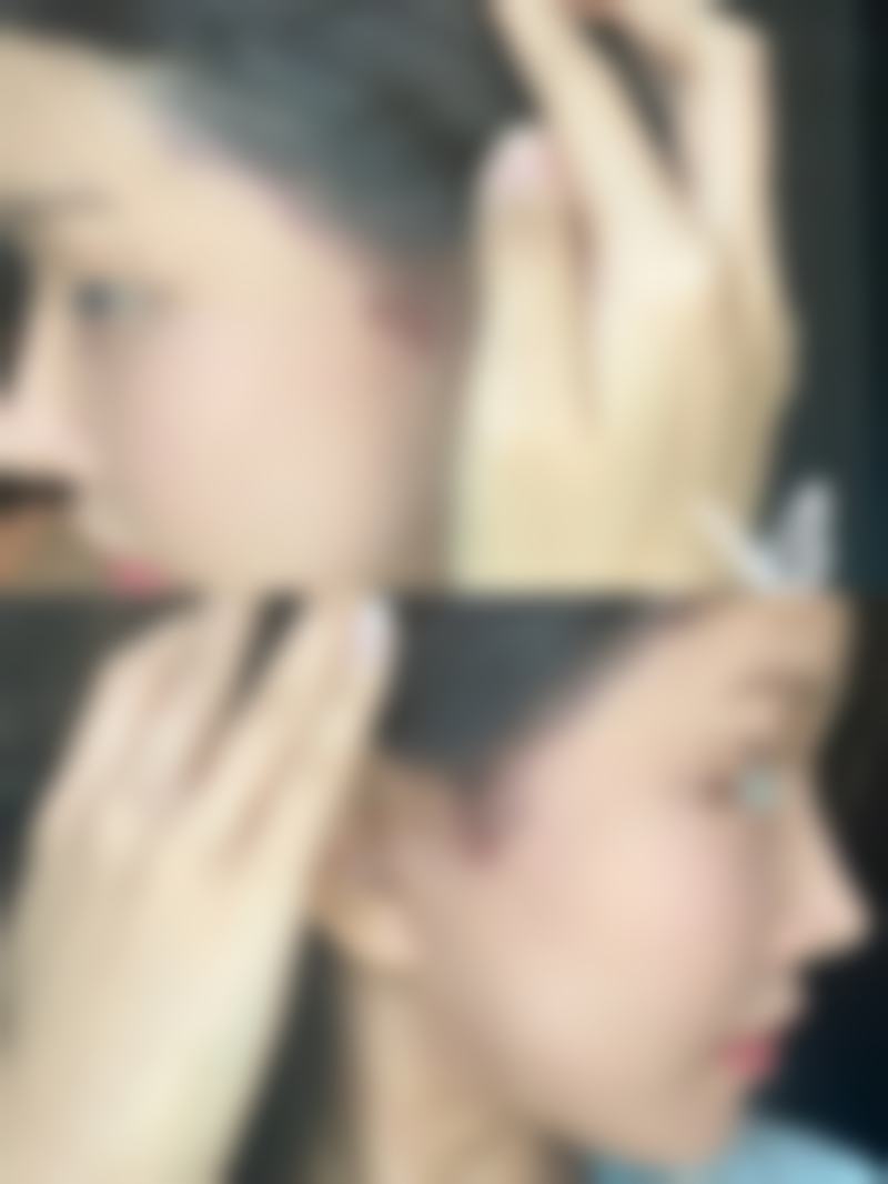 四、罗湖区中医院整形美容科开展的项目