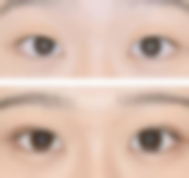 李森恺项目价格表参考