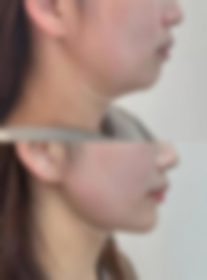 傅常清改脸水平怎么样可靠吗？