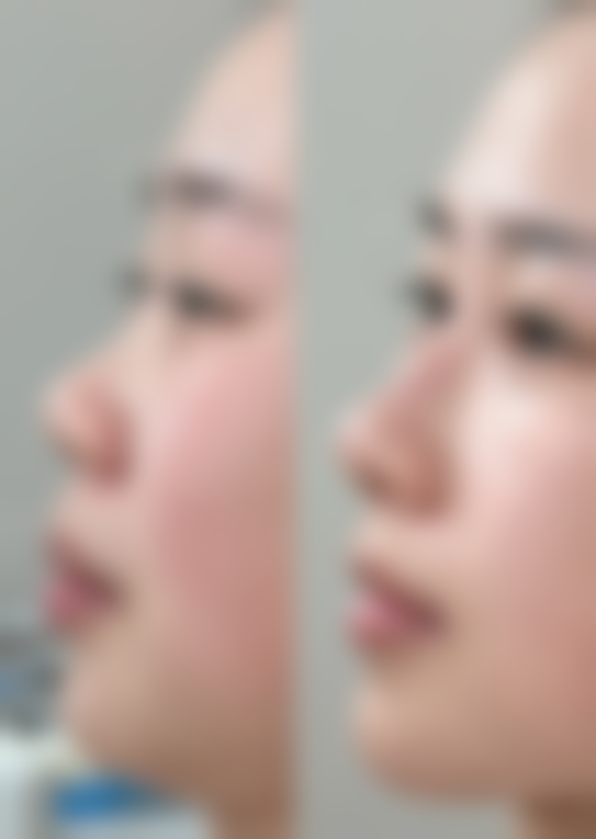 八、韩国UK整形医院真实的顾客评价如下: