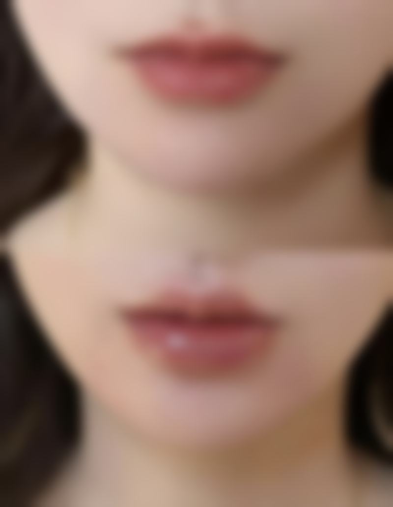 陈突牙齿美学修复实例