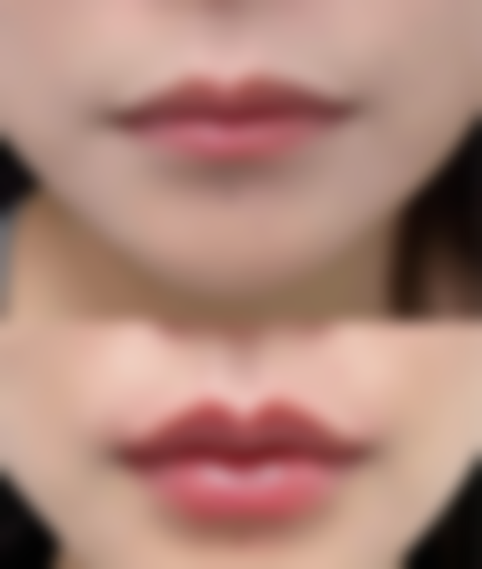 七、保定雷胜辉医疗美容整形外科诊所价格表：（仅供参考）