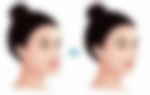 许凡平隐形正畸水平怎么样可靠吗？