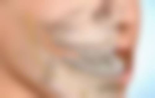 许凡平隐形正畸实例