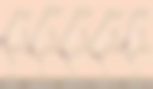 更快更好去眼袋攻略：选择靠谱的医美机构