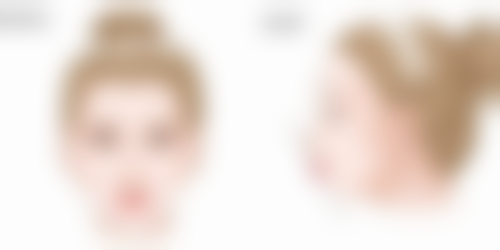 揭秘双眼皮消肿之医美干预手段