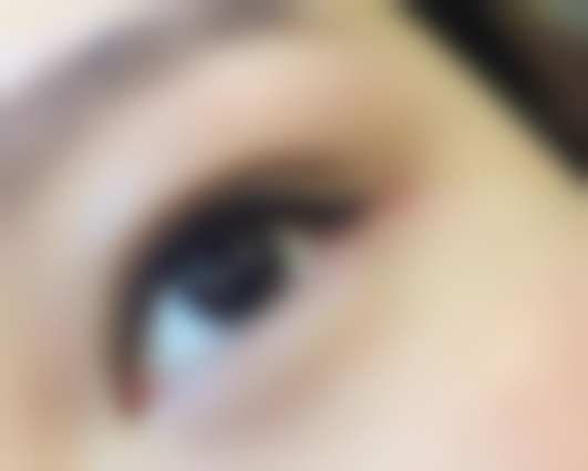 双眼皮埋线线断裂概率几何？理性看待与积极应对