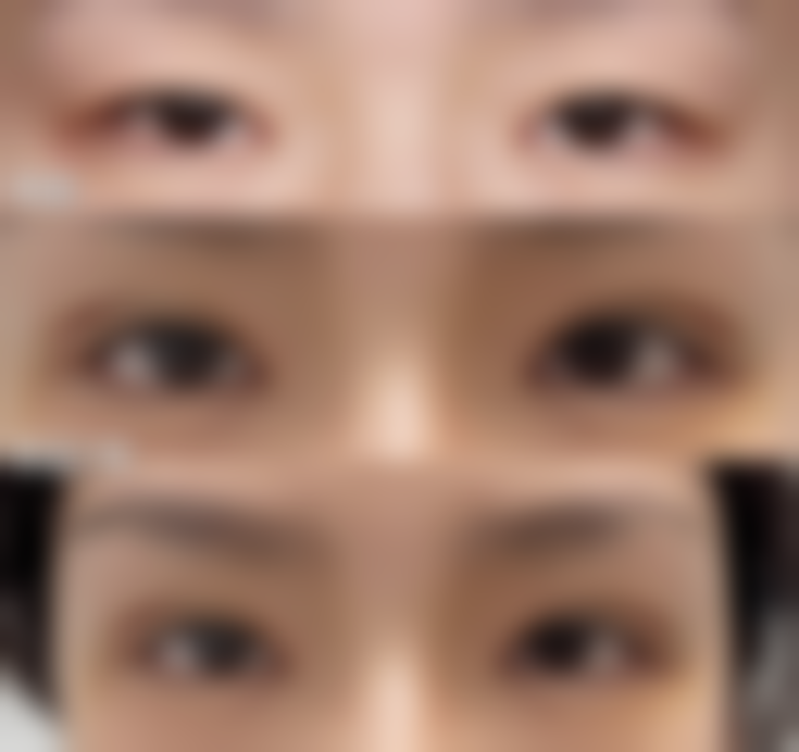 六、南昌柠檬一美医疗美容诊所怎么预约：