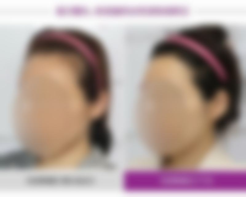 七、南昌柠檬一美医疗美容诊所价格表：（仅供参考）