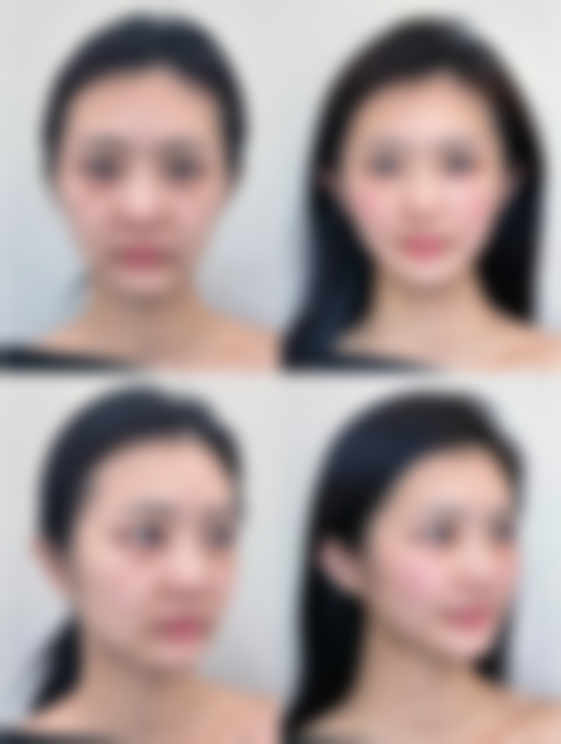 八、重庆美弗整形医院真实的顾客评价如下：