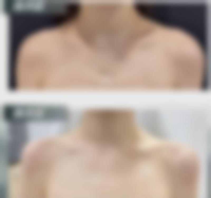 如何修复疤痕成效好?联合治疗提升修复成效