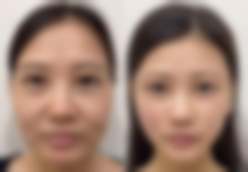 重拾美丽自信!自然美眼轻松拥有