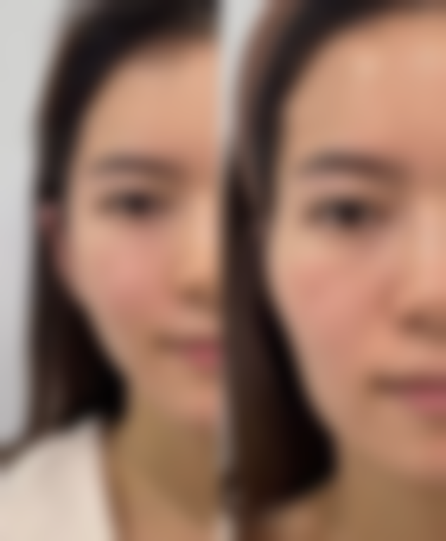 坚持科学护理，眼部焕发光彩