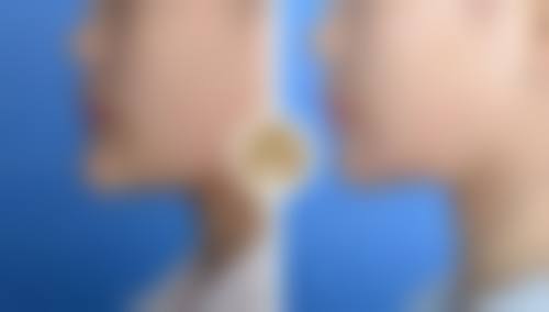 揭秘！不同方法的优势对比，选对才是关键