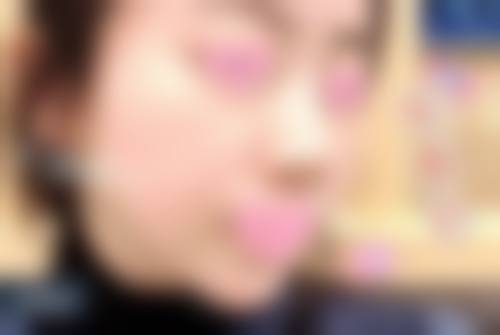 五、成都春语医疗美容门诊部实例