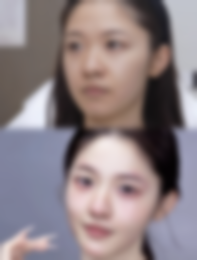 五、武汉领秀植发医院怎么预约：