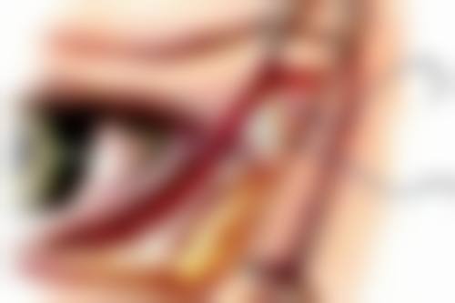 大腿吸脂后多久能同房？专精医院助力修复