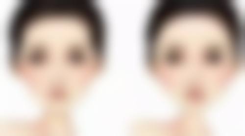 手术去眼袋修复期的异常症状观察与应对