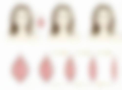 想彻底祛除眼袋？选对方法是关键，医学手段结合日常护理还你明亮双眸 