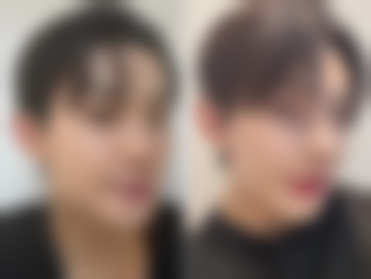 影响疤痕的因素：可控与不可控