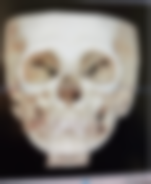 选择靠谱医院，开启美丽蜕变