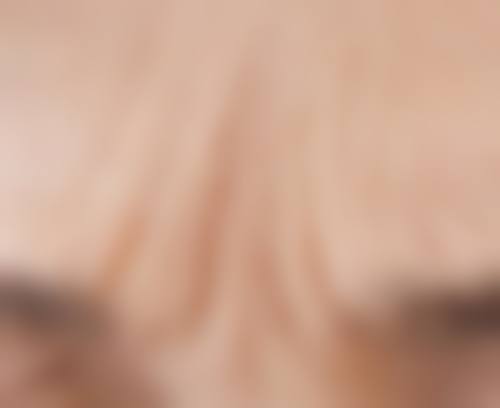 科学治疗，耐心等待肌肤焕新