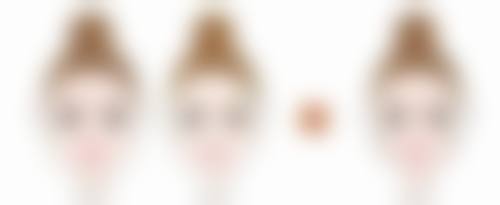 全切双眼皮疤痕修复有妙招！药物辅助修复来帮忙