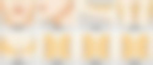 全切双眼皮疤痕修复有妙招！硅酮凝胶的神奇功效