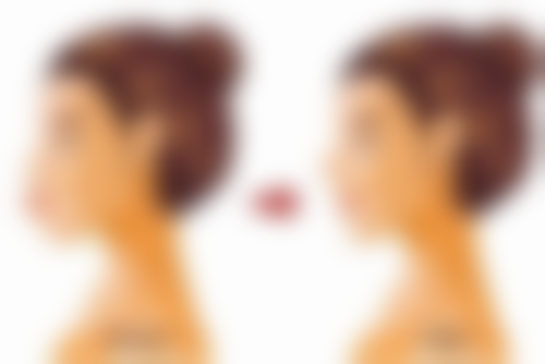 抽脂手术风险揭秘：术前术后注意事项，保护手术成效