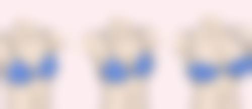 面部拉皮除皱成效好在哪?正规医院有保护