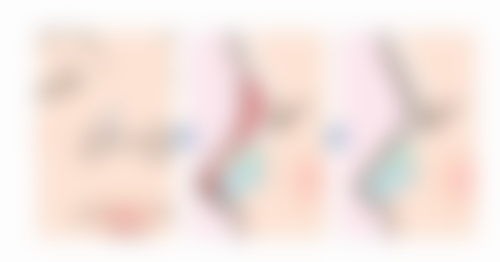 四、广州柏美医学美容医院实例