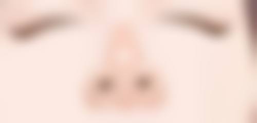 面部拉皮除皱成效好在哪?个性化方案更自然