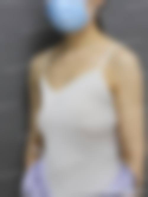 孟春丽美胸实例