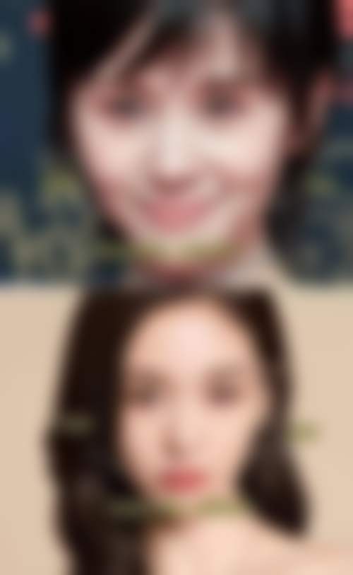 董岩岩眼部整形实例