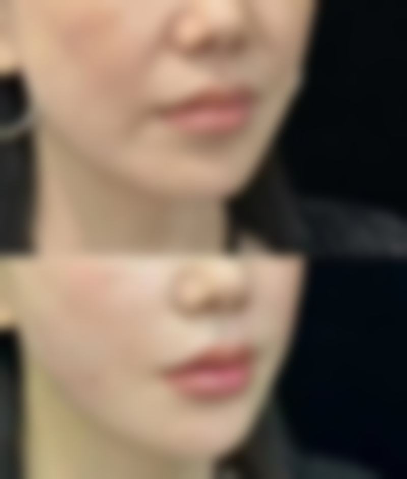 眼袋重度别乱选！不同成分眼霜优势