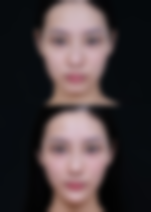 董玉洁怎么预约?