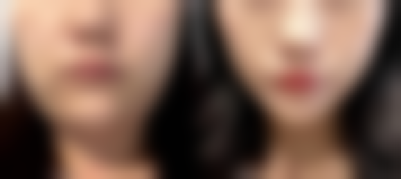 六、南宁市第二人民医院整形美容外科价格表：（仅供参考）