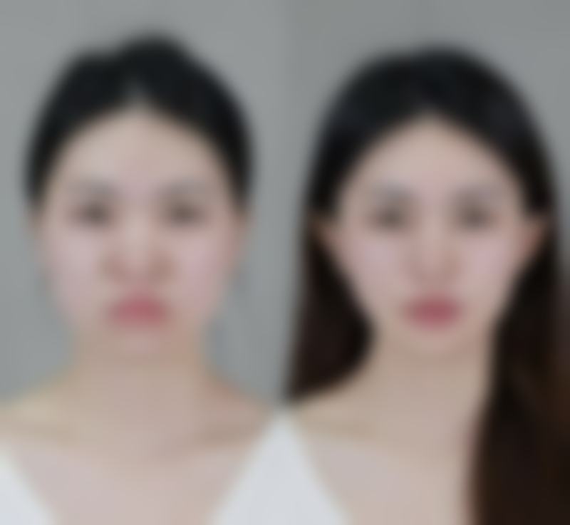 朱艳琼皮肤美容实例