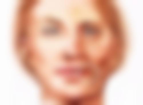 耳软骨隆鼻鼻尖显形？稳定期后修复方案