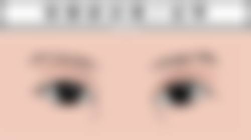 身上黑色疤痕去除攻略大揭秘！信心满满告别黑疤