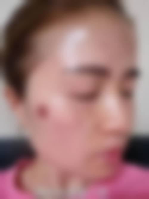 莫丽仙项目价格表参考